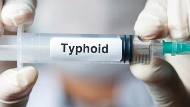typhoid