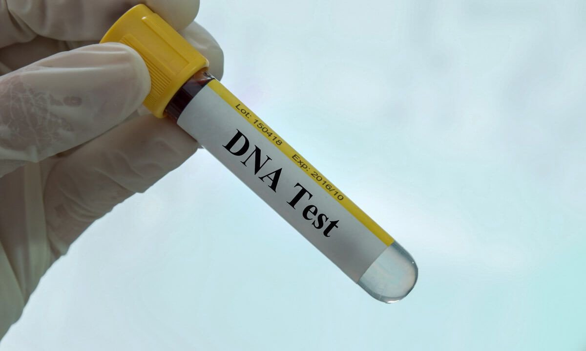 DNA
