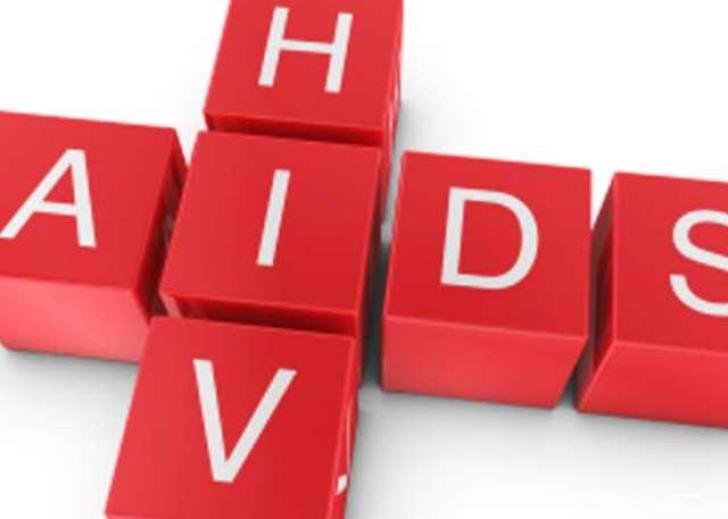HIV and AIDS